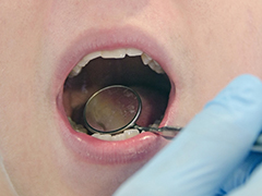 虫歯を放置する危険性